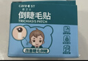 Care1st儿童倒睫毛贴婴儿宝宝矫正流眼泪上下眼睑下垂内翻提拉神器眼皮贴 实拍图