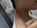 艾修堂砭石艾灸仪艾灸盒三伏随身按摩棒经络刷家用便携悬灸罐刮痧板礼盒 实拍图
