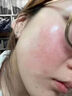 透真油橄榄精华液舒缓晒后修护屏障受损泛红收缩毛孔淡化痘印敏感肌 实拍图