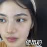 焦博士日本377美白祛斑霜氨甲环酸祛斑乳膏烟酰胺美白淡化黑色素去黄褐 实拍图