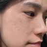 沃森博士氨甲环酸乳膏去黄褐斑传明酸凝胶分解黑色素提亮肤色修护精华液 实拍图