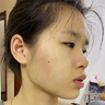 Aromat Herbs澳洲进口祛痘面膜祛痘印补水保湿美白控油收缩毛孔去黄提亮男女士 实拍图