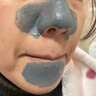 白云山清洁面膜壬二酸泥膜棒去黑头粉刺祛痘去角质收缩毛孔控油40g/支 实拍图