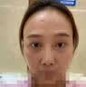 眼袋去除神器眼霜去大眼袋严重中老年男女士专用消除黑眼圈精华油 特i效*1盒霜+1盒膜【超强疗效】 实拍图