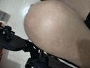 怡辉（YIHUI）轮椅骨折可抬腿轻便折叠老年人专用出行年轻人骨折便携式可自推 实拍图