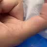 [扶他林]双氯芬酸二乙胺乳胶剂 20g 1盒装 腱鞘特炎效药进口软膏治手指大拇指疼痛手腕腱鞘专炎用药正品腱鞘囊肿凝胶 腱鞘燚炎国药准字正品 实拍图