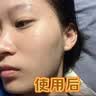 维特丝痘痘贴帖消炎吸脓修复痘印医研舒缓祛痘星星款隐形痤疮专用青少年 实拍图