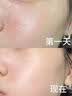 透真油橄榄精华液舒缓晒后修护屏障受损泛红收缩毛孔淡化痘印敏感肌 实拍图