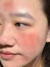 维特丝芦荟胶补水保湿晒后修复凝胶面霜祛痘印收缩毛孔滋润嫩肤男女士 实拍图