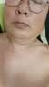 【京东大药房官方直售旗舰】点痣膏无痕药水祛痣套装黑点脸部痦子无痛黑痣斑点神器官方正品店 点痣膏（1瓶） 实拍图