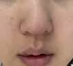 白云山壬二酸泥膜棒*2+鼻贴+鼻膜套装去黑头粉刺清洁面膜收缩毛孔控油 实拍图