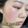 达里博士  DR.DARRY寡肽冻干粉修护皮肤屏障增厚角质层舒缓敏感术后修复血丝礼物 实拍图
