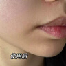 维特丝痘痘贴帖消炎吸脓修复痘印医研舒缓祛痘星星款隐形痤疮专用青少年 实拍图