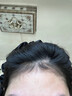焦博士日本防脱洗发水育固发养发生姜侧柏叶增发密发女男专用进口原料 实拍图