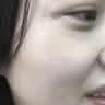 樱空制薬疤克巴克祛疤膏儿童医用硅酮疤痕凝胶去疤痕专用修复除疤膏烧烫伤 实拍图