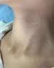 [臣功]维A酸乳膏 15克/支 3盒装 刺猴去好根瘊疣膏猴子去除药膏猴子扁平疣去除药膏刺猴专用的药特寻常疣鱼鳞痣小肉粒效 长年反复疣瘊肉粒一次用到位 实拍图