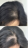 蔓迪女士生发喷雾30ml*3瓶【超值疗程装】5%米诺地尔酊（脱发严重女可用） 实拍图