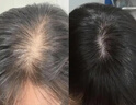 蔓迪【二代米诺地尔】蔓迪5%生发泡沫剂60g(倍速温和) 男士专用治脱发防脱洗发水育发米洛原液酊搽剂 实拍图