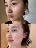 OHBT面膜美白淡斑补水保湿男女士熬夜舒缓抗皱紧致去黄气暗沉提亮肤色 实拍图