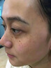 倾颜烟酰胺凝胶美白祛斑霜去黄提亮祛黄褐斑雀斑淡化色斑改善暗沉护肤 实拍图