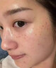 倾颜烟酰胺凝胶美白祛斑霜去黄提亮祛黄褐斑雀斑淡化色斑改善暗沉护肤 实拍图