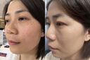 OHBT面膜美白淡斑补水保湿男女士熬夜舒缓抗皱紧致去黄气暗沉提亮肤色 实拍图