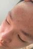 [豆克]复方珍珠暗疮片 0.3g*36片 1盒装 祛痘去痘痘消炎痤疮专用闭口粉刺青春痘祛痘痤疮专用药脸上去痘痘的药清热解毒下巴 实拍图