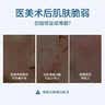 伊肤泉（EVE CHARM）医用护理液体敷料1.5ml*30支 透明质酸钠敷料械字号精华术后屏障 实拍图