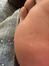 [信龙]水杨酸软膏 去脚底老茧去硬皮老茧软化膏茧子去除去老茧去脚底老茧硬皮鸡眼膏去肉刺药膏根无痛脱落 5%*20g 1盒装 【医用级药膏】 实拍图