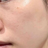 维特丝痘痘贴帖消炎吸脓修复痘印医研舒缓祛痘星星款隐形痤疮专用青少年 实拍图