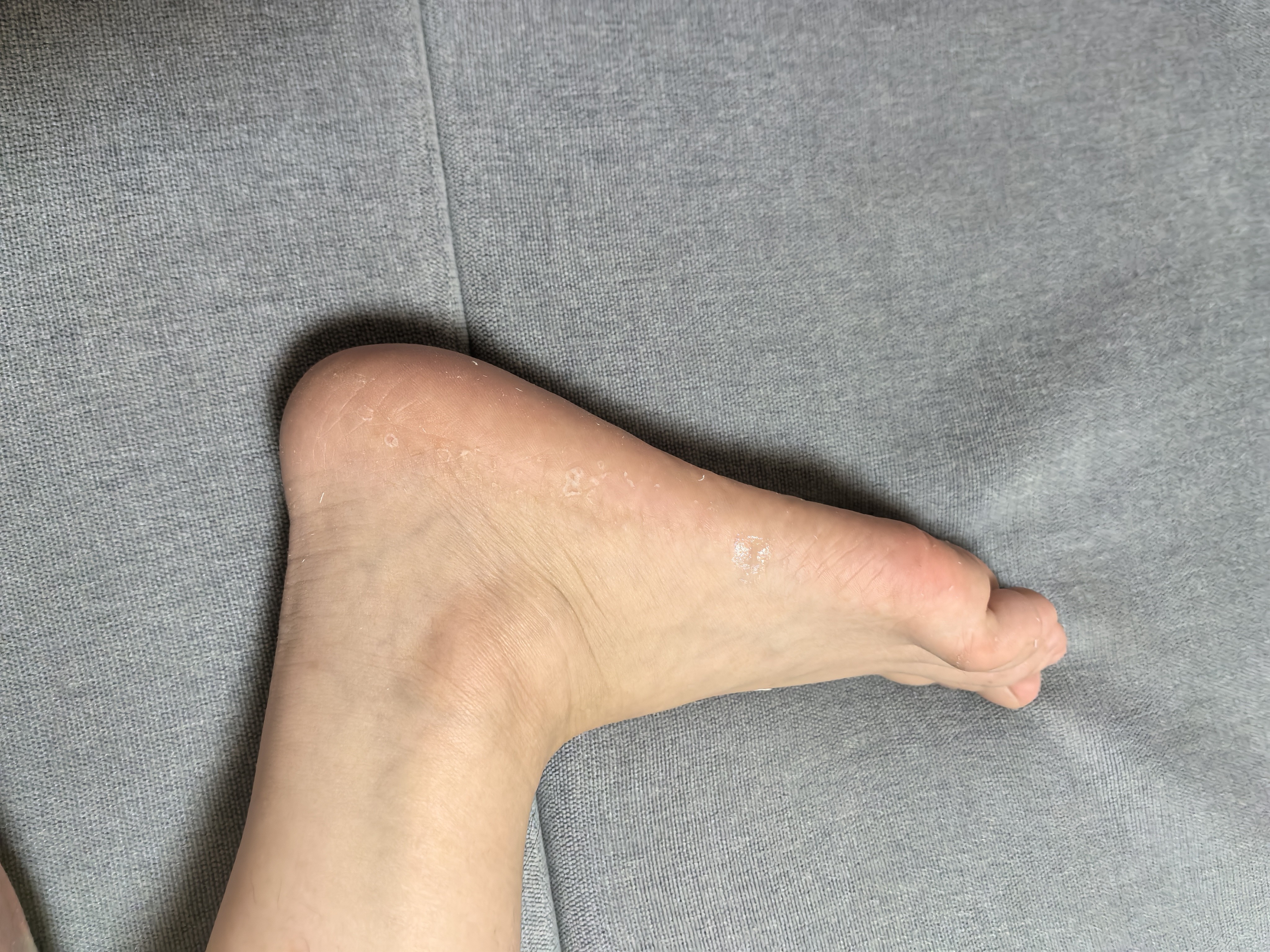 凡士林[口碑第一]修护晶冻100g防干裂夜间修护敏肌适用（新老包装随机） 实拍图