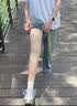 ZEAMO医用护膝保暖关节炎半月板损伤夏季薄款登山徒步男女运动专业防护 实拍图