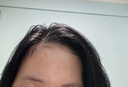 半岛激光生发仪医用级生发帽中重度防脱发控油产后脱发家用272颗 晒单实拍图