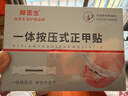 脚医生甲沟炎专用矫正器正甲贴纠正神器嵌甲脚趾甲矫正贴片1套 实拍图