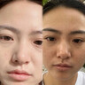 OHBT面膜美白淡斑补水保湿男女士熬夜舒缓抗皱紧致去黄气暗沉提亮肤色 实拍图