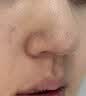 白云山壬二酸泥膜棒*2+鼻贴+鼻膜套装去黑头粉刺清洁面膜收缩毛孔控油 实拍图