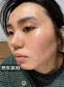 DR.MICKEY医用重组生长因子凝胶牛碱性成纤维细胞点痣喷人表皮祛疤痕膏修复 实拍图