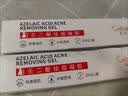 肤润康15%壬二酸凝胶祛痘膏修复淡化痘坑印疤痕去黑头粉刺收毛孔 一支【甲级专研急救祛痘】 实拍图