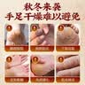 关德兴香港宝芝林脚后跟干裂皲裂膏马油凡士林手足脚裂膏开裂防裂膏 实拍图