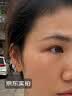 川廿制药烟酰胺凝胶精华液祛斑美白淡化黑色素医用男女士专用搭熊果苷乳膏 实拍图