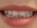 高露洁（Colgate）美白笔 液体牙贴涂抹式亮白去黄去牙渍女生礼物 2.5ml/支 实拍图