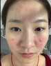 朵初颜祛痘膏【正品直售】舒缓淡化消红去痘印净白嫩白修复痘印去痘痘膏 【性价比款】壬二酸祛痘膏28g*1支 实拍图