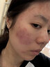 维特丝芦荟胶补水保湿晒后修复凝胶面霜祛痘印收缩毛孔滋润嫩肤男女士 实拍图