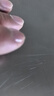 芙林 盐酸阿莫罗芬搽剂5%*1.5ml 灰指甲专用药重度灰指甲指甲增厚发黄变厚真菌感染药非乳膏灰指甲药 实拍图