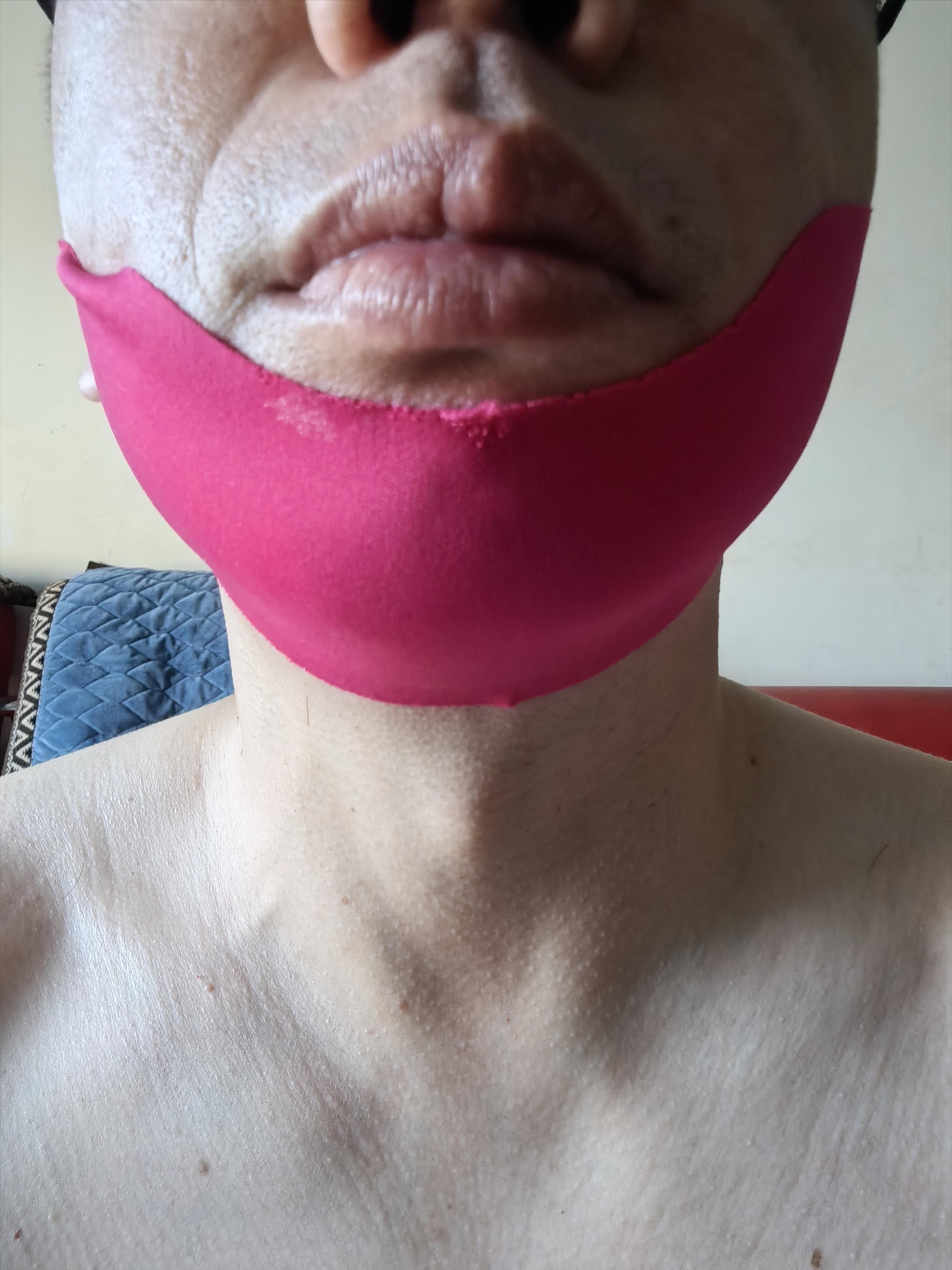 迪丽诗顿v脸神器面膜绷带提拉紧致睡觉物理脸部提升防下垂塑男女睡眠款1盒 实拍图