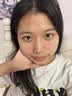 优理氏 寡肽冻干粉精华液祛痘淡化痘印痘坑毛孔收缩次抛男女士修护粉刺 实拍图