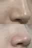 康佳（KONKA）黑头吸出器吸黑头仪器清理神器面部小气泡清洁美容仪男女士毛孔粉刺清洁器生日礼物送男女友 全配款-小气泡清洁仪+精华水+气泡水+6种吸头 实拍图