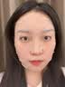 OHBT面膜美白淡斑补水保湿男女士熬夜舒缓抗皱紧致去黄气暗沉提亮肤色 实拍图