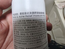 蓓安亲研后背祛痘喷雾 前胸口背部去痘美背水杨酸背粒消【大容量200ml】 实拍图