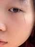 [花容美]阿达帕林凝胶 祛痘药膏祛痘印修复淡化痘印医用祛痘消炎痤疮专用青少年祛痘消炎痤疮专用皮肤用药 0.1%*10g 1盒装 【脸上起粉刺】 实拍图